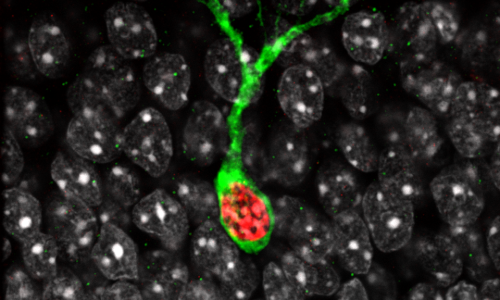 Epigenetics – Beyond Mendelian Genetics?